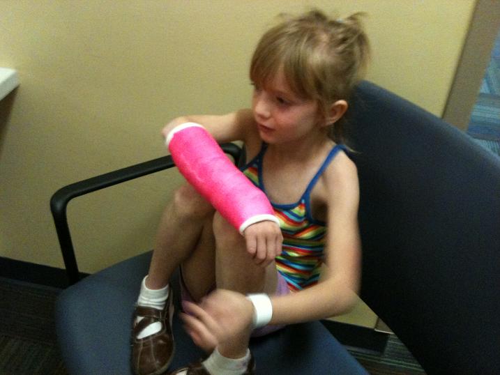 pink arm casts